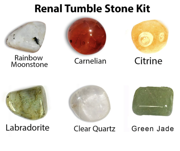 Renal Tumble Stone Kit